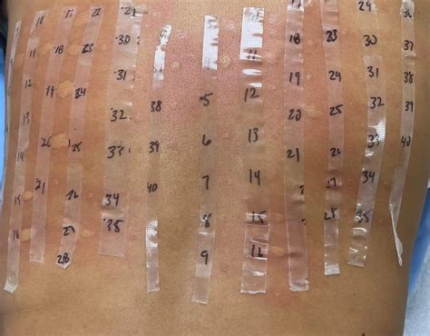 Allergy Test at Shinagawa .